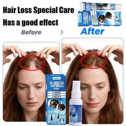 🔥 Sumifun Original Hair Growth Cream – Fast & Effective Results